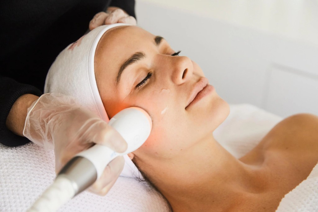 Apollo Duet treatment along the cheek