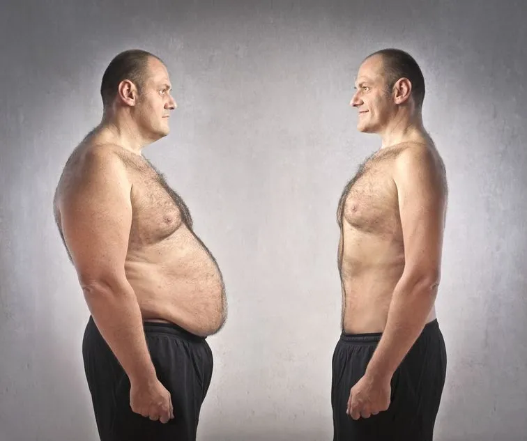 Before and after Emerald Laser body contouring