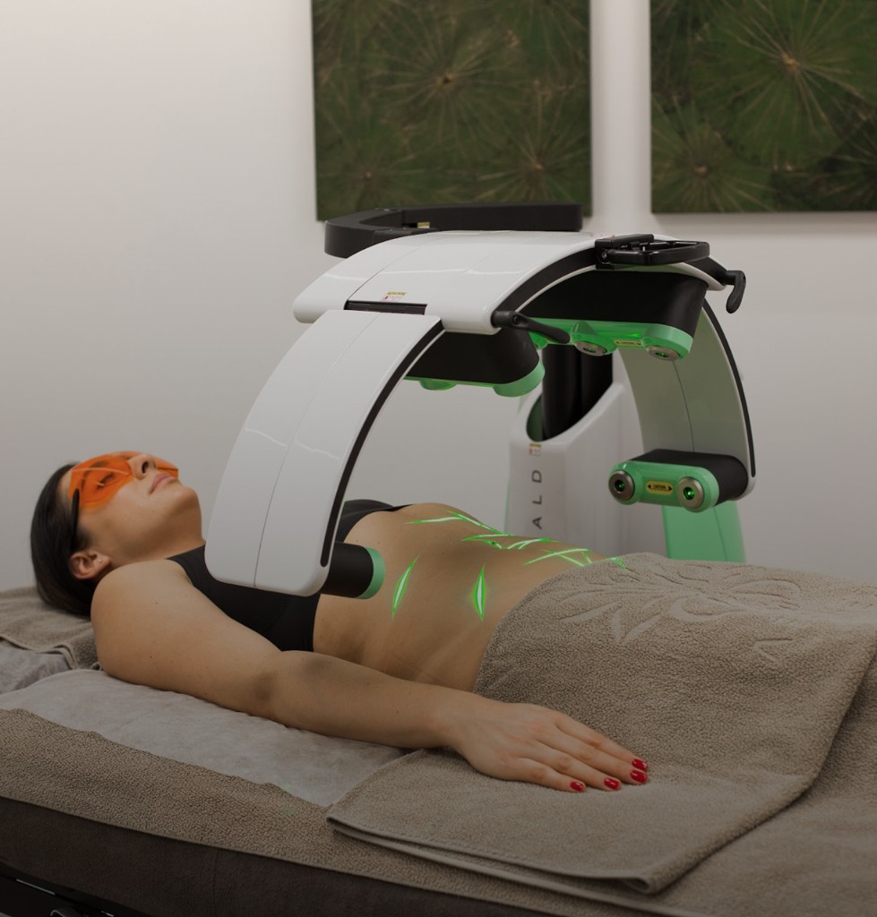 Emerald Laser treatment over the abdomen